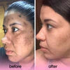 Turmeric and Kojic Acid Pads